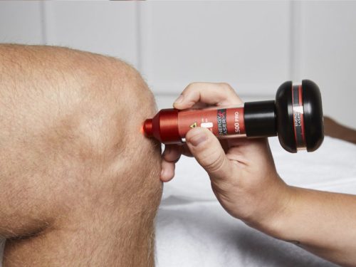 Energy-Laser L500 Pro laserový prístroj