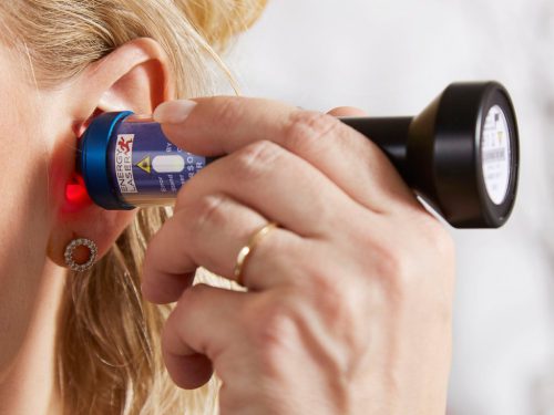 Personal Laser L400 laserový prístroj