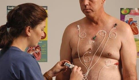 Čo treba vedieť o Holter EKG vyšetrení