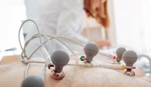 EKG – čo treba vedieť o elektrokardiografickom vyšetrení