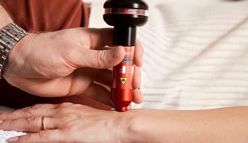 Laser terapia pri zápale šliach – terapia tendinitídy