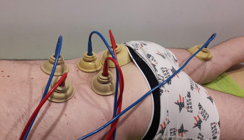 Liečba ischiasu s vákuovými elektródami
