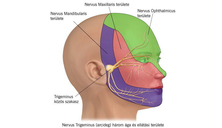 Arcigedgyulladas-nervus-trigeminus-3-aga.png