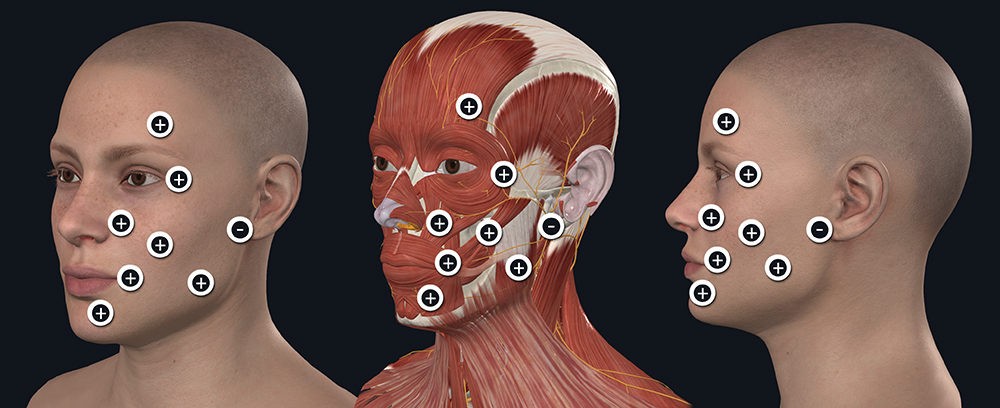 Bell-palsy-arcideg-benulas-kezelesi-pontok.jpg