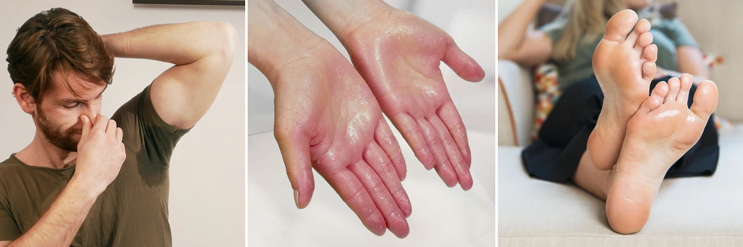Hyperhidrosis-koros-tenyer-talp-izzadas-2.jpg