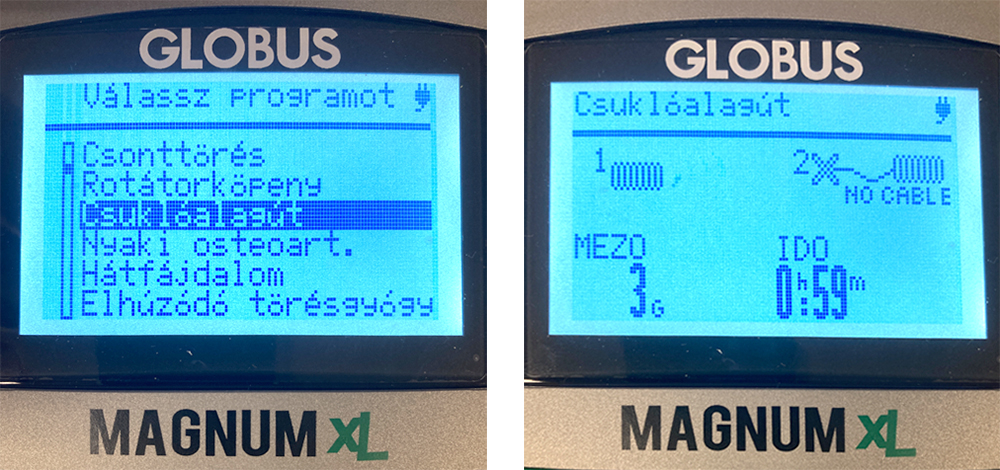 csukloalagut-szindroma-magnesterapias-kezelese-programvalasztas.jpg